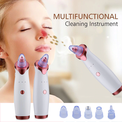 N1 Electric Blackhead Remover Pore Vacuum Suction Dermabrasion Face Cleaner