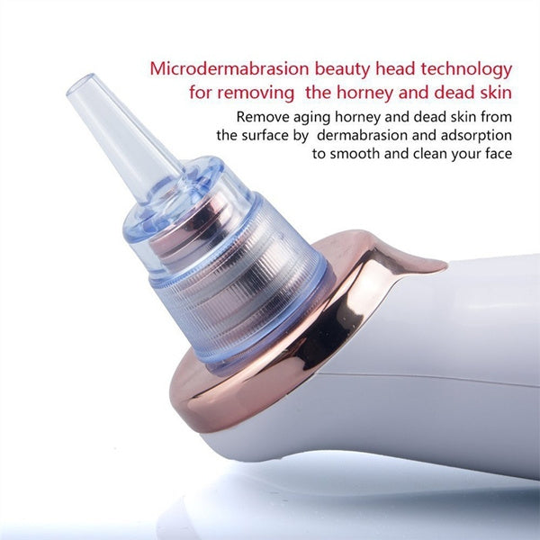 N1 Electric Blackhead Remover Pore Vacuum Suction Dermabrasion Face Cleaner